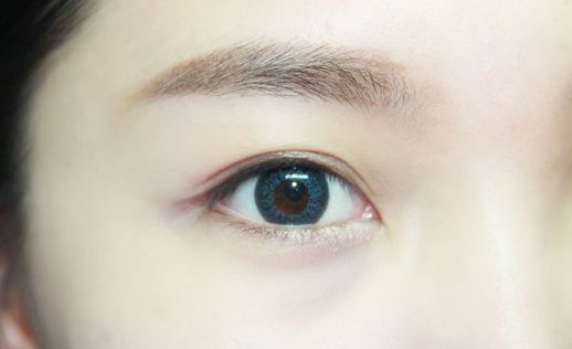 無錫頸脖紋線雕整形醫(yī)院推薦指南：提升魅力，告別頸紋困擾