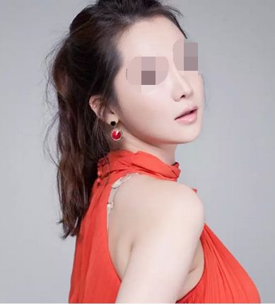 雙眼皮整形術(shù)術(shù)后需要注意些什么？