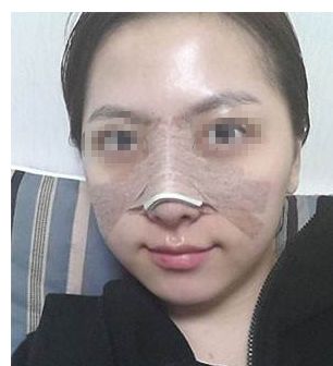 告別私處暗沉！盡顯白皙嬌嫩，激光漂紅來一次就有效果嗎？巧妙俘獲男人的心！