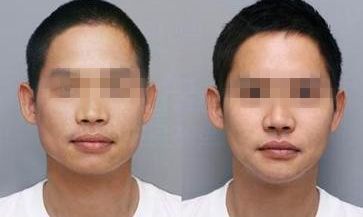 擁有瓜子臉特點的人有哪些？