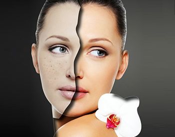 北京雙眼皮修復(fù)的效果如何？什么狀況需要做雙眼皮修復(fù)？