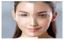吃海鮮對于使用瘦腿針的人來說是否適合？