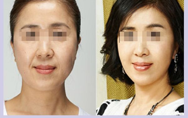 有關男性和女性腰圍的標準，您需要了解的關鍵信息