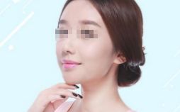 雙眼皮修復(fù)，選對(duì)時(shí)機(jī)，展現(xiàn)美麗眼眸