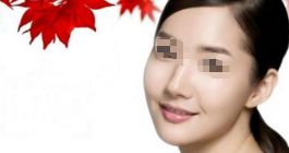 下巴整形手術(shù)有哪些方法？下頜角整形是否安全？