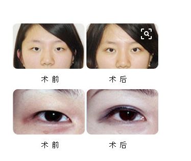 恢復處女膜：經(jīng)驗分享與修復方法
