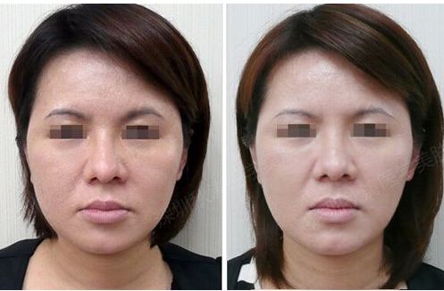 獨(dú)家分享：腹部瘦身秘籍及完美護(hù)理指南在線解讀