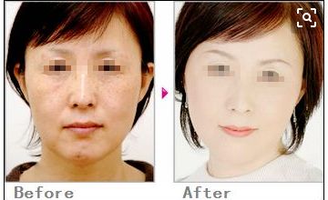 獨(dú)家分享！塌鼻子的完美發(fā)型指南，為你打造精致生活