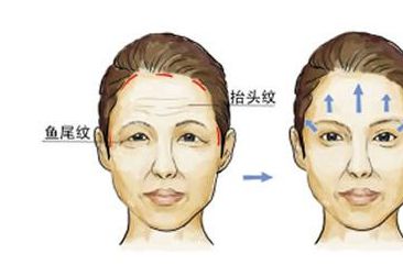 胸部整形費(fèi)用不同？這些因素竟會(huì)影響價(jià)格