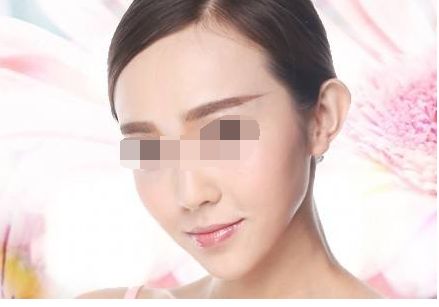 透明質(zhì)酸隆鼻：塑造完美鼻型的多重優(yōu)勢(shì)