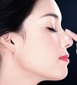 蘭州親民市唇部隆鼻打玻尿酸的價(jià)格如何？