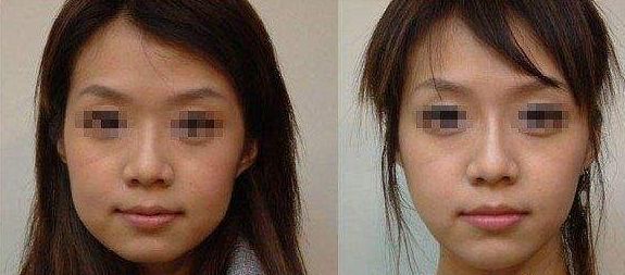 長期外眼角傷害視力？這樣保護眼睛更有效！