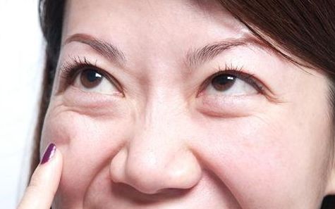 上海九院去眼袋專家推薦，最全擅長項目及費用一覽