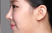 東莞第五人民醫(yī)院美容科綜合評價及專家推薦！