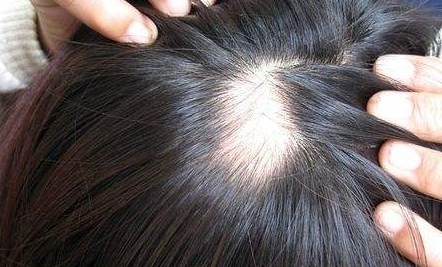 南京新生醫(yī)院植發(fā)效果如何？坐診專家簡介、詳細(xì)地址一覽
