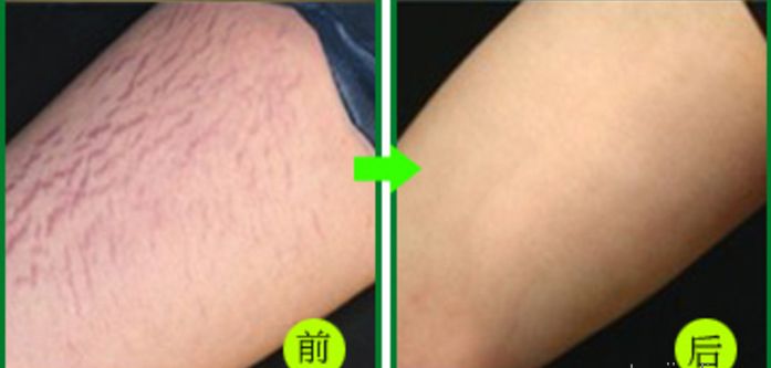 杭州整容醫(yī)院推薦，這幾家非常值得選擇