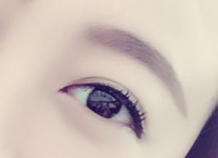 劉春軍豐胸手術(shù)后效果如何？費用怎么樣？醫(yī)生概況+隆胸真實案例圖為參考