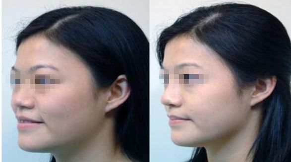 濟南市哪家整形醫(yī)院正規(guī)專業(yè)？推薦可靠的名單