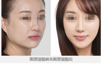2024年昆明哪家整形醫(yī)院更受歡迎？你一定不知道！