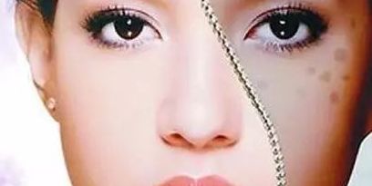 上海眼部修復(fù)專家推薦，治療眼部問題可信賴！