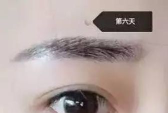 成都江濤雙眼皮術醫(yī)生坐診地點及案例分析