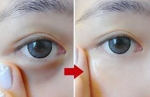 南通人民醫(yī)院眼科專家團(tuán)隊(duì)露面！這5位備受好評(píng)的專家赫然名列其中