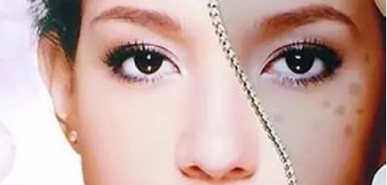 周一雄如何預(yù)約雙眼皮手術(shù)？案例分享與價(jià)格真實(shí)評估