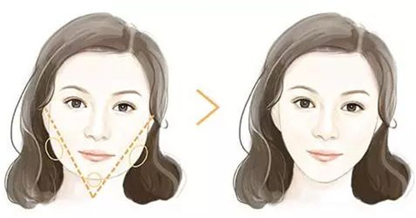 深圳吸脂修復(fù)醫(yī)院哪家專業(yè)？這八強機構(gòu)到底有何絕技？