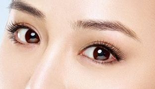 成都米蘭柏羽雙眼皮曝光！醫(yī)生做雙眼皮風(fēng)格如何？對(duì)比照片供參考