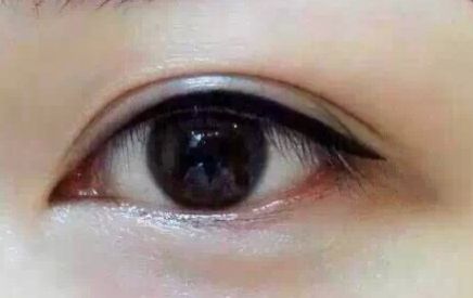 上海9院專家分享軟骨隆鼻案例，LiQingfeng的技術(shù)備受推崇！