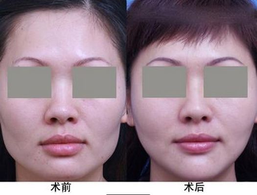 中國最受歡迎的十大整形醫(yī)院評選結(jié)果公布 中國最受歡迎的十大整形醫(yī)院評選結(jié)果公布