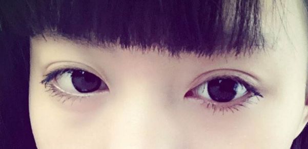 靠前重慶眼部整形醫(yī)院榜單出爐，時(shí)光整形受認(rèn)可