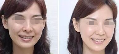 佛山哪家整形醫(yī)院超好的，超皮秒技術(shù)厲害的名單公布