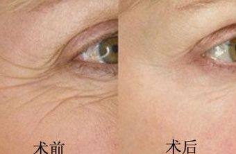 南京鳳凰島整形外科門診部的王科醫(yī)生口碑如何？聯(lián)合李敏醫(yī)生介紹及手術(shù)后的反饋，揭秘這位醫(yī)生的實(shí)力！