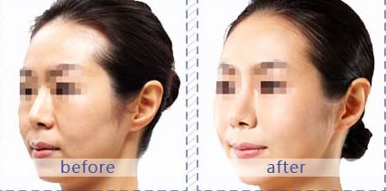 成都哪家醫(yī)院適合皮膚美容？