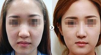 廣州中大光華醫(yī)院，品質(zhì)獲GL國際認證，真實患者評價分享