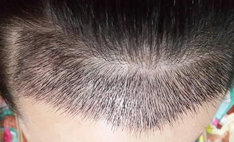 蒲城縣醫(yī)院簡介：如何了解蒲城縣醫(yī)院的特色服務(wù)與專業(yè)醫(yī)療團(tuán)隊？