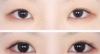 廣州韓后許滿萍醫(yī)生的專業(yè)領(lǐng)域揭秘，令人驚喜的嫩膚案例分享