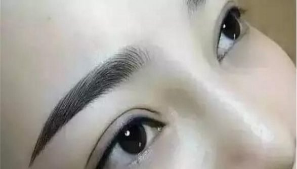 重慶曹陽的鼻子整形效果如何？醫(yī)生手藝獨步天下的真實案例分享