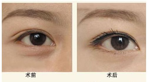 廣州墊下巴哪家醫(yī)院好？口碑技術(shù)分析及價(jià)格參考