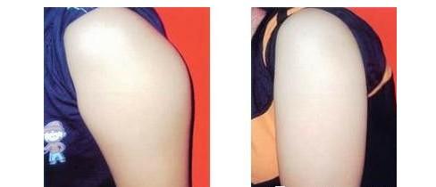 上海九院的整形價(jià)格表是怎樣的？它適合想要變美的人嗎？