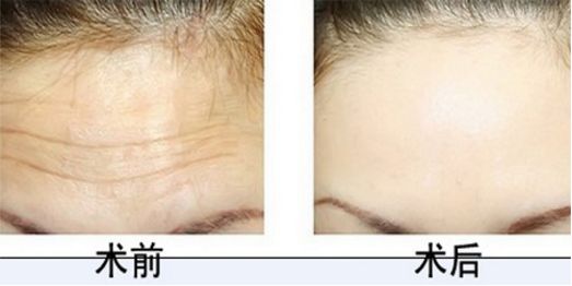 排行榜前十！沈陽(yáng)植發(fā)醫(yī)院技術(shù)高超有口碑