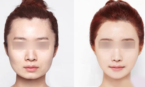 昆明哪里有最好的眼部手術(shù)整形醫(yī)院？2024年10家排名搶先曝光！