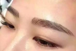 絕佳效果！體驗(yàn)成都周維開刀雙眼皮的精彩案例