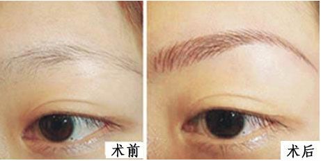 上海九院整形外科醫(yī)生排名新鮮發(fā)布！3位專家各具特長！