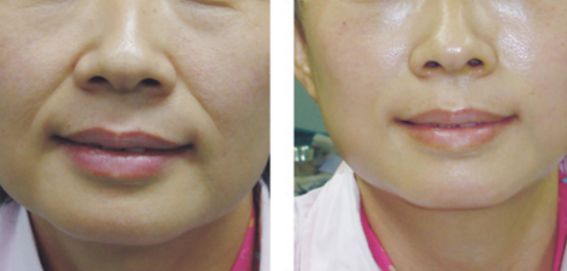 哪位醫(yī)生是擅長進行顱頜面手術(shù)的專家？名單更新與價格參考