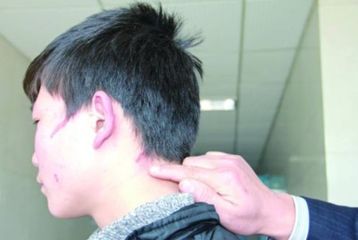 上海哪家醫(yī)院的紋身去除技術(shù)更專業(yè)，排名榜單推薦，實力強大！