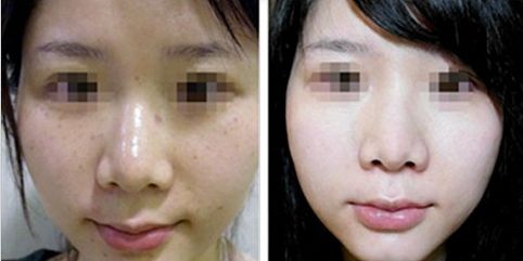 合肥哪幾家三甲整形醫(yī)院受歡迎？