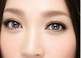 2023年，出色表現(xiàn)的國外進(jìn)口玻尿酸排行榜前十品牌揭曉！