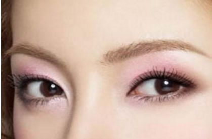 北京協(xié)和醫(yī)院白明醫(yī)生的雙眼皮手術(shù)效果如何？真實(shí)案例展示給你看